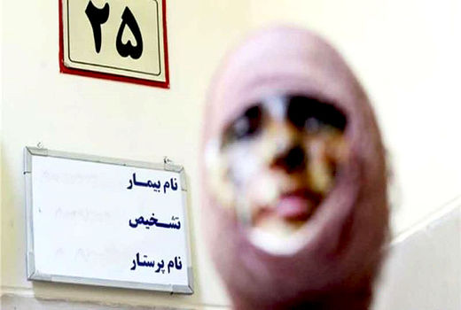 تشدید مجازات؛ راه کنترل اسیدپاشی و حمایت از قربانی